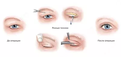 Сангапури (пластика азиатских век)