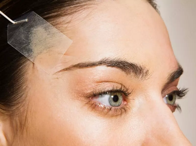 Пластическая хирургия. Височная подтяжка