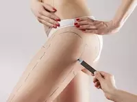 по запросу Пластическая хирургия: подтяжка бёдер