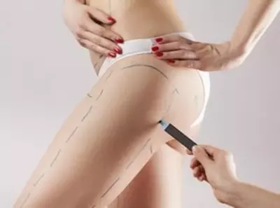 Пластическая хирургия: подтяжка бёдер