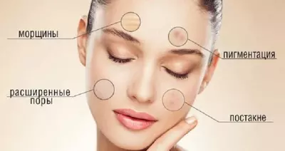 Косметология: пилинг (арт 01)