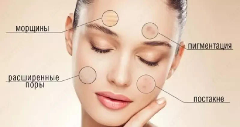 Косметология: пилинг (арт 01)