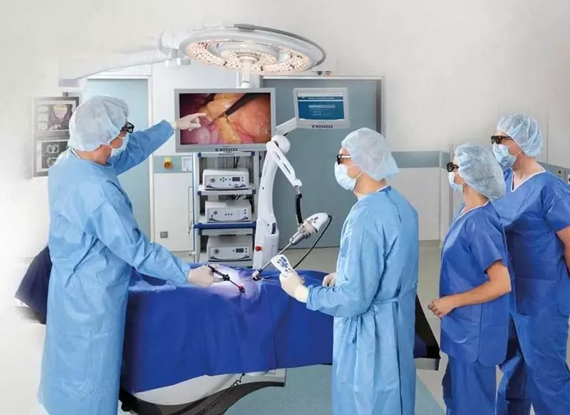 Лапароскопическая операция при камнях в желчном пузыре