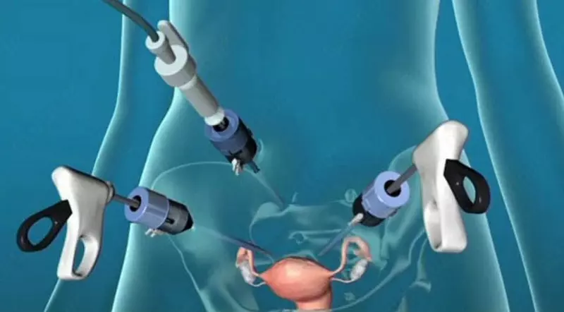 Лечение гинекологических заболеваний с помощью лапароскопии - по запросу