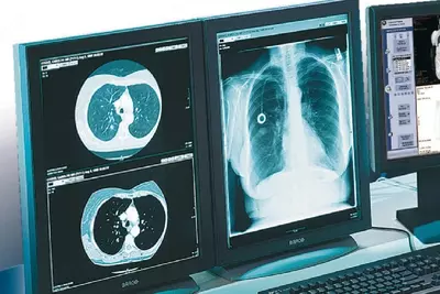 Цифровое рентгеновское обследование