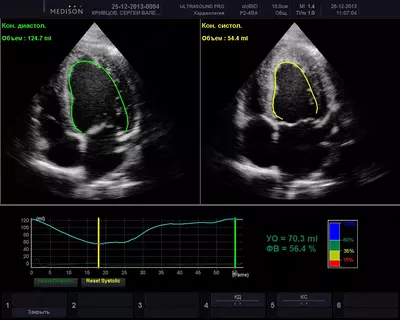 Цена по запросу Эхокардиография