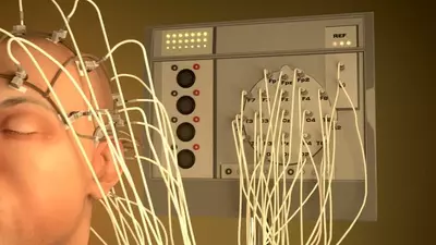 Цена по запросу Электроэнцефалография (ЭЭГ)