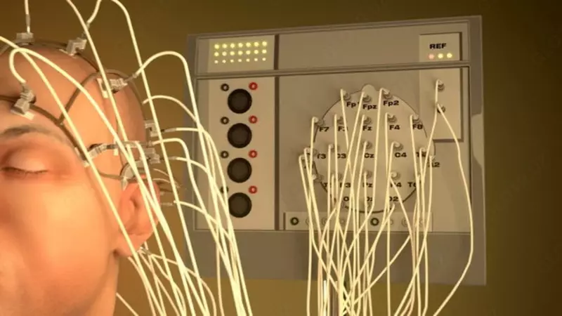 по запросу Электроэнцефалография (ЭЭГ)