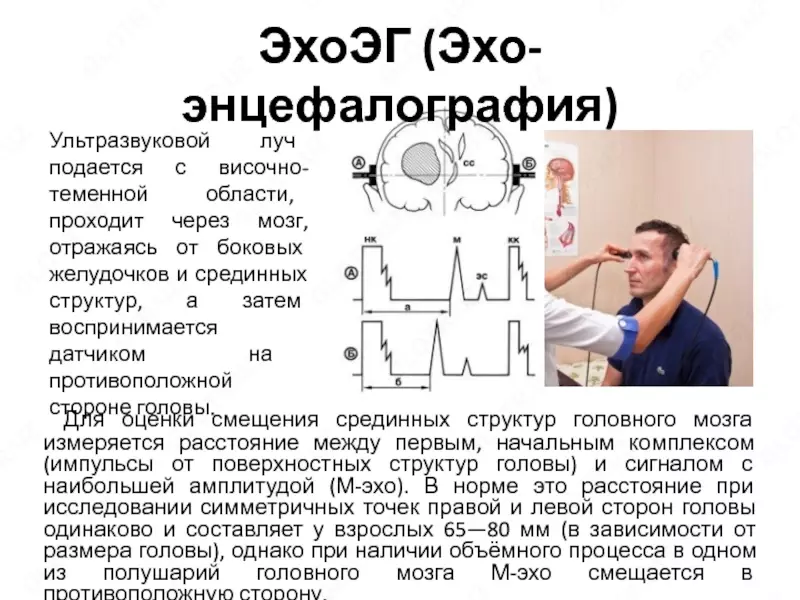Echoensefalografiya (Echo-EG) - по запросу