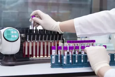 Лабораторные тесты - Цена по запросу