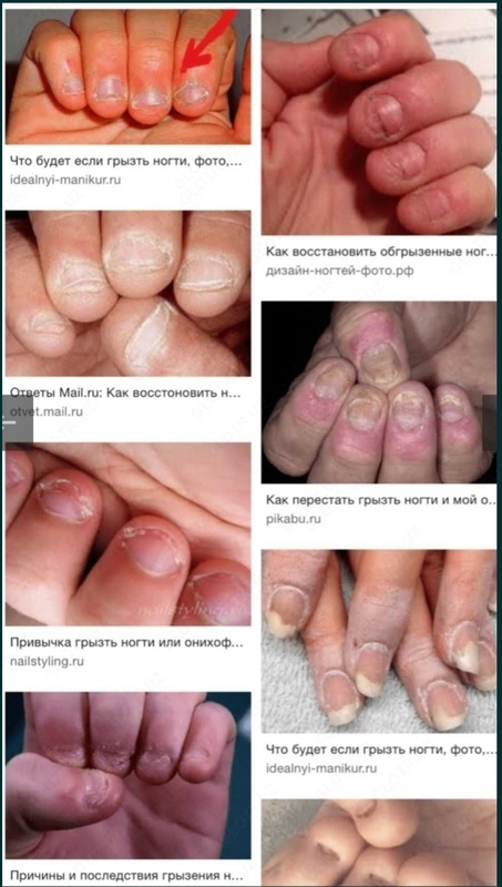 110 000 so'm Tirnoqlarimni tishlashdan kemirishni xohlamayman