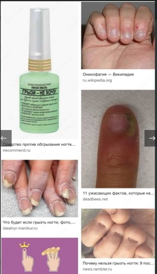 &quot;Fransuzcha&quot; Aqlli emal Men kemirmoqchi emasman Chakana savdo