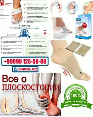 «Фиксатор» для коррекции искривления стопы