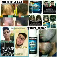 Миноксидил Киркланд 5% соч сокол остириш учун махсулот - 180 000 сум