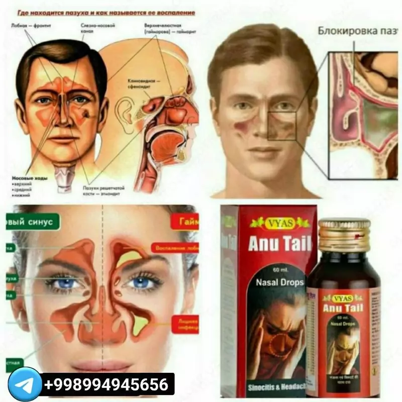 Sinusit "Anu Tail"dan burun uchun tomchilar - 190 000 so'm