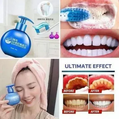 Отбеливающая зубная паста со вкусом черники - 130 000 сум / шт.