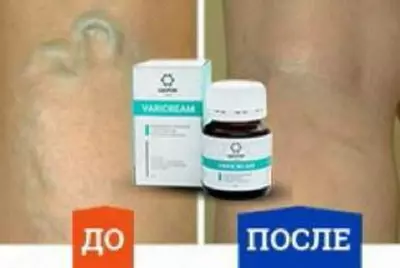 Крем ЗДОРОВ VARICREAM от варикоза - 190 000 сум / шт.
