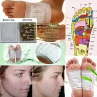 Kinoki plastiri ozish uchun