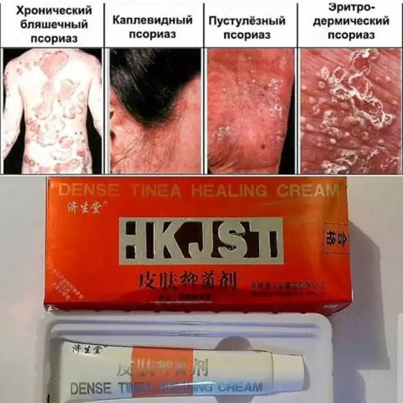 Крем от псориаза DENSE TINEA HEALING CREAM - 140 000 сум