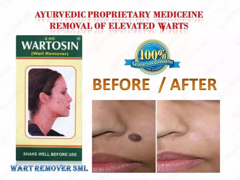 Wartosin-borodavkaga qarshi Vartosin - 220 000 so'm