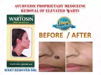 Гель от папиллом Wartosin (Вартосин)