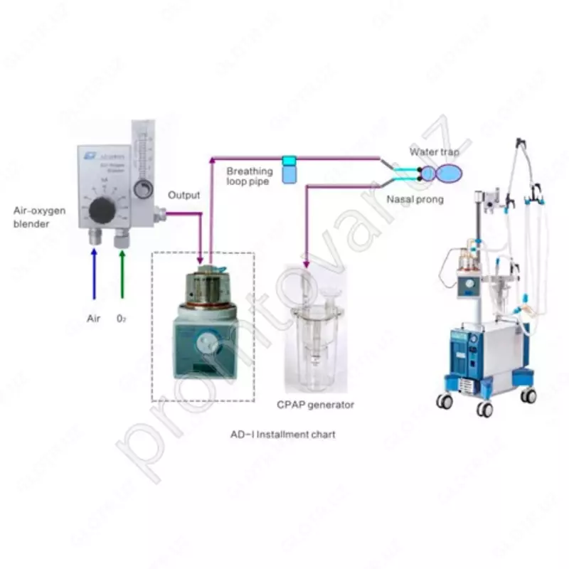 ИВЛ неонатальный nCPAP NEONATE NCPAP AD-I