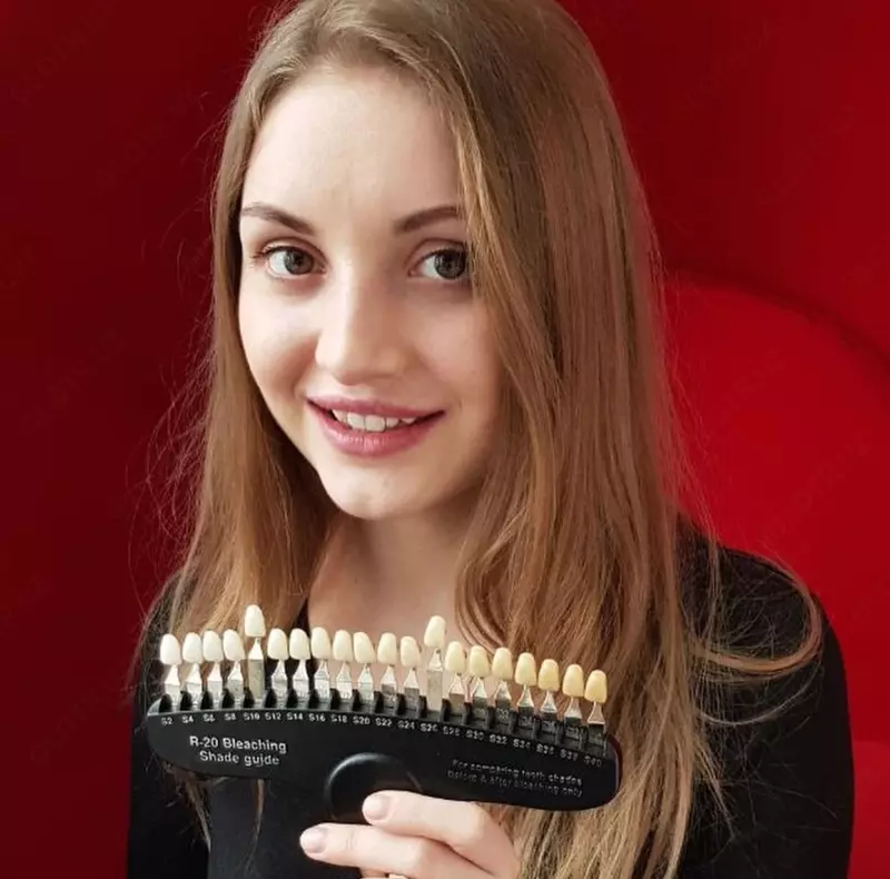  Франшиза косметического отбеливания зубов Smile LAB Smile LAB Франшиза косметического отбеливания зубов