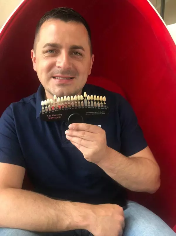 Франшиза косметического отбеливания зубов Smile LAB