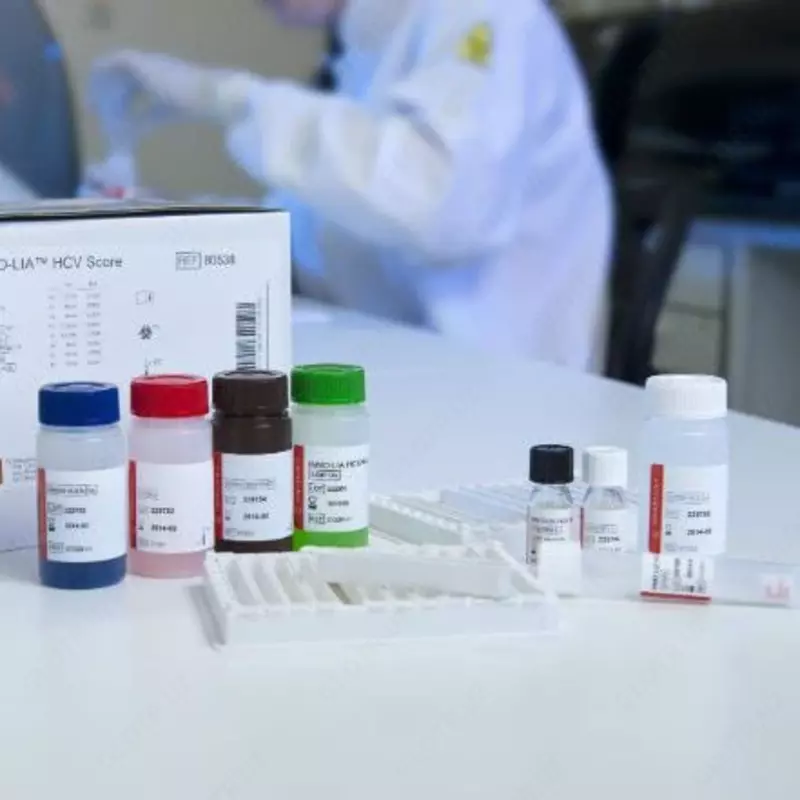 Анализ на HCV-Ab