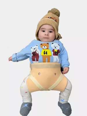 Chanoq son displaziyasida qollaniladigan shina freyka