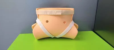 Chanoq son displaziyasida qollaniladigan shina freyka - 230 000 so'm / dona