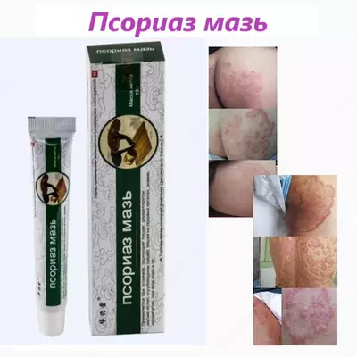 Мазь против псориаза