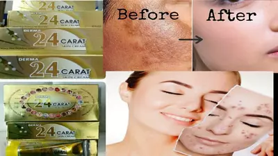 Davolovchi krem Derma 24 Carat (Teri kasalliklari uchun)