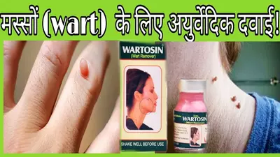 Вартосин от бородавок и папиллом (Wartosin Wart Remover)