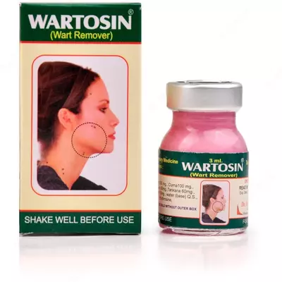 Вартосин от бородавок и папиллом (Wartosin Wart Remover)
