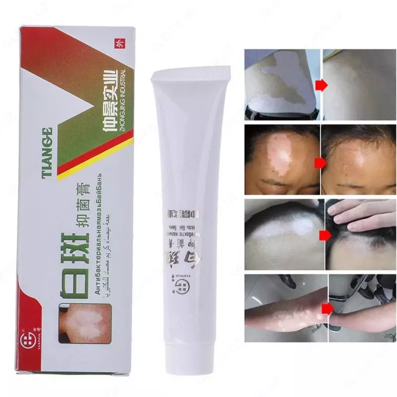 Мазь от витилиго Тианге Бай Бань (БайБань) Tiange