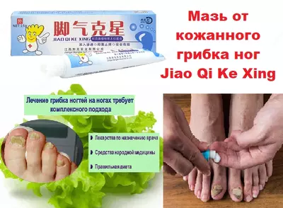 Мазь от кожанного грибка и пота ног Jiao Qi Ke Xing (желтые ножки)