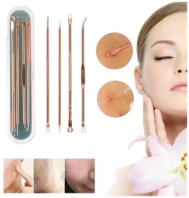 Набор инструментов для чистки лица от прыщей и черных точек Sweet Beauty