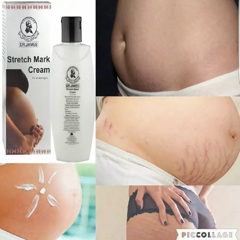 Крем от растяжок Dr. James