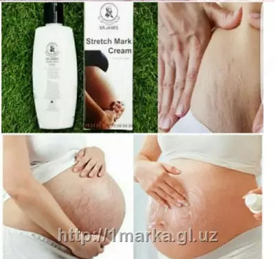 Крем от растяжок Dr. James