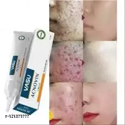 Крем для лица против прыщей и угрей Acnovin Cream Vasu