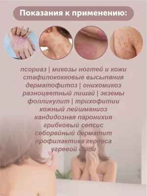 Травяная мазь "Король кожи", 15 гр