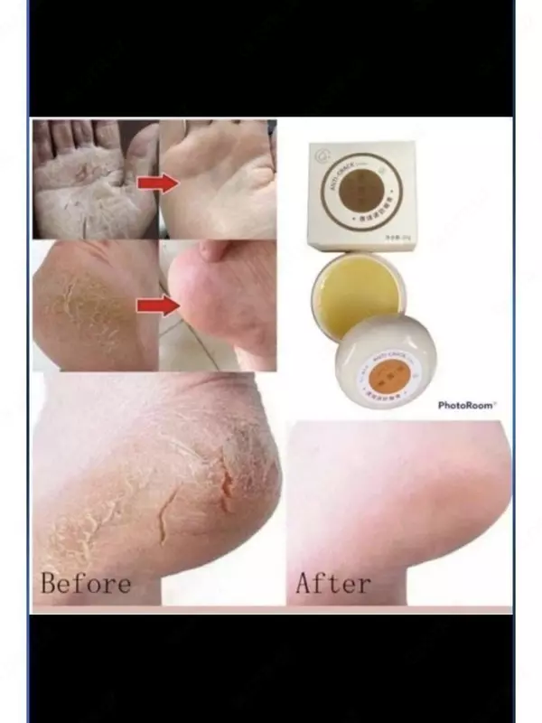 Волшебный крем от трещин и сухости ног и рук Anti-Crack Cream