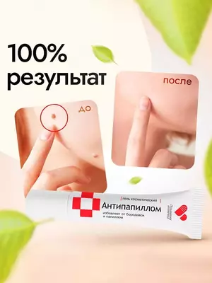 Антипапиллом - крем-гель от бородавок и папиллом