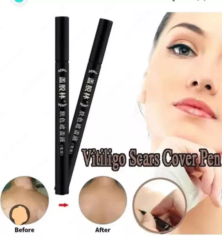 Витилиго фломастер Xishengyan