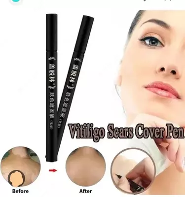 Витилиго фломастер Xishengyan