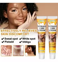 Vitiligo kremi Vitiligo Care Cream HBESTY - 110 400 so'm