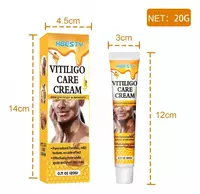 Vitiligo kremi Vitiligo Care Cream HBESTY Marviza