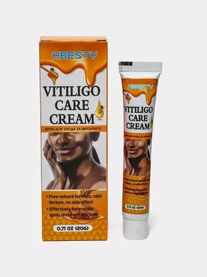 Vitiligo kremi Vitiligo Care Cream HBESTY