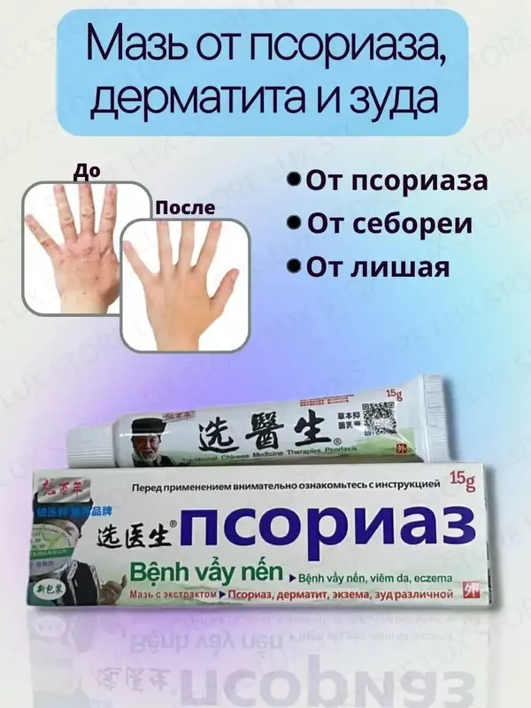 Китайская мазь от псориаза Benh Vay Nen Xuanysheng, 15 гр